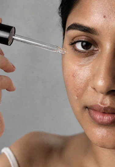 Can Niacinamide Help Fade Acne Marks? Benefits, Results & How It Works