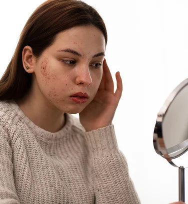 Damaged Skin Barrier: Signs, Causes & How to Support Recovery