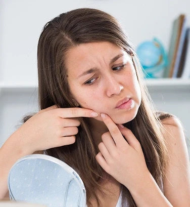 Stop Trying to Kill Every Acne Bacterium: Your Skin Microbiome Is More Complicated Than That