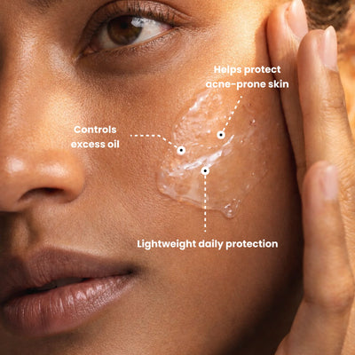 Lightweight sunscreen for acne-prone skin