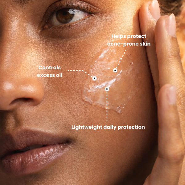Lightweight sunscreen for acne-prone skin