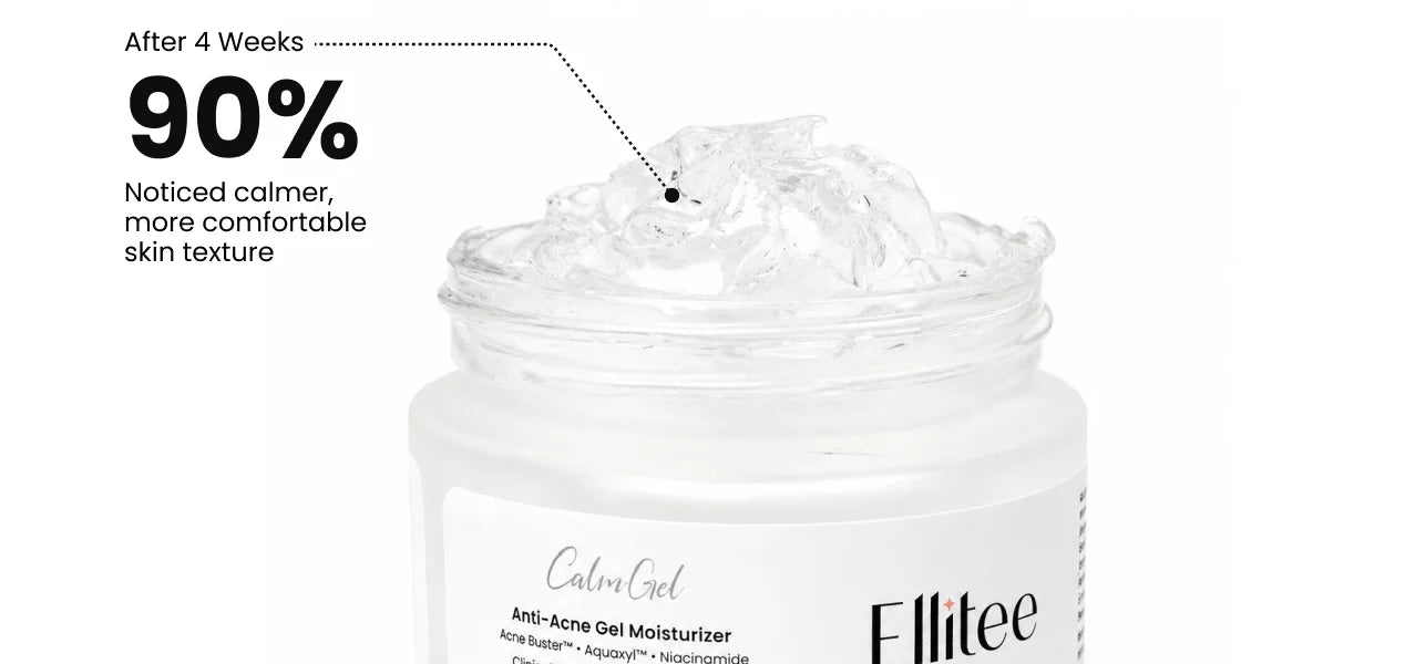 CalmGel Anti-Acne Gel Moisturizer