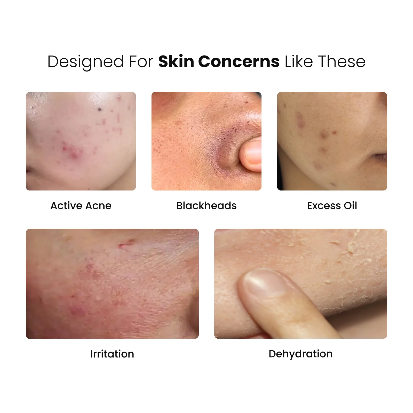 Pigmentation & Skin Balance Routine Combo