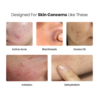 Pigmentation & Skin Balance Routine Combo