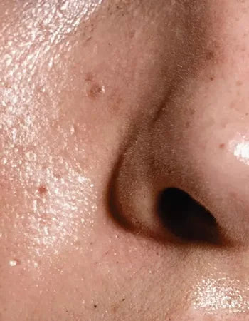 Oily & Combination Skin