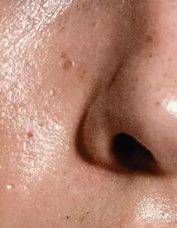 Oily & Combination Skin