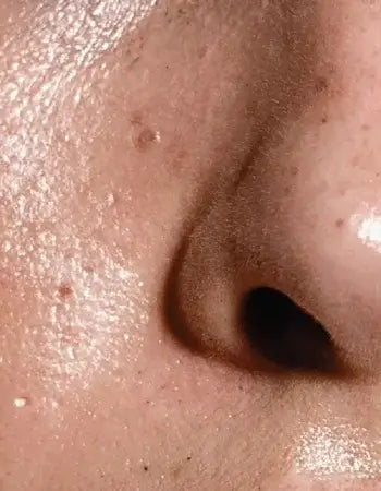 Oily & Combination Skin
