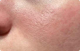 Minimizes visible redness for a more balanced look