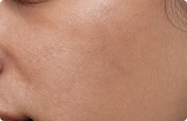 Support More Even-Looking Skin