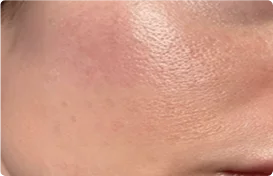 Supports Calm, Comfortable Skin