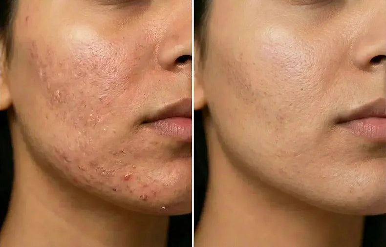 Uneven Texture